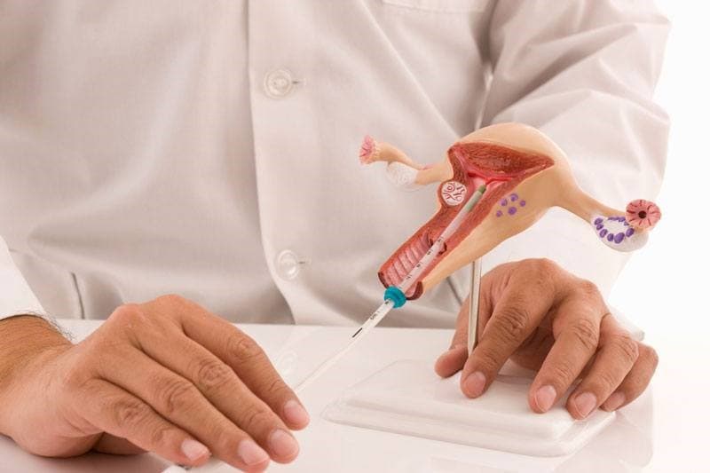 Cách xử lý xoắn tinh hoàn để không mất khả năng sinh sản