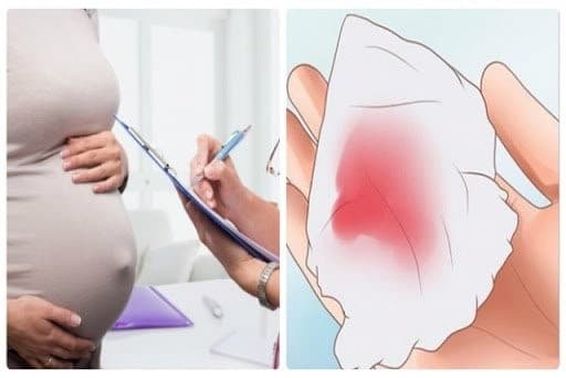 Hiện tượng kinh nguyệt màu đen có đáng lo ngại?