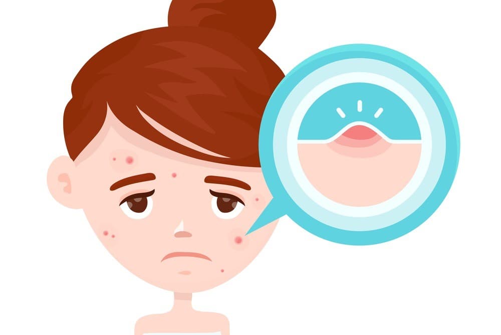 Các dấu hiệu sắp có kinh dễ nhận biết trước 1 tuần