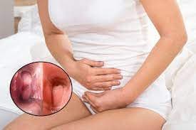 Phân biệt sớm: Dấu hiệu báo kỳ kinh và dấu hiệu mang thai khác nhau thế nào?