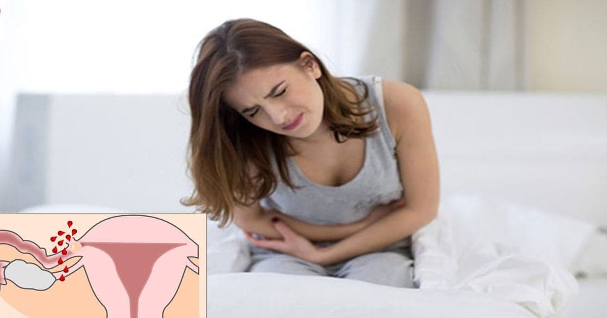 Dấu hiệu chửa ngoài dạ con chị em cần nắm rõ để tránh nguy hiểm cho cả mẹ và bé