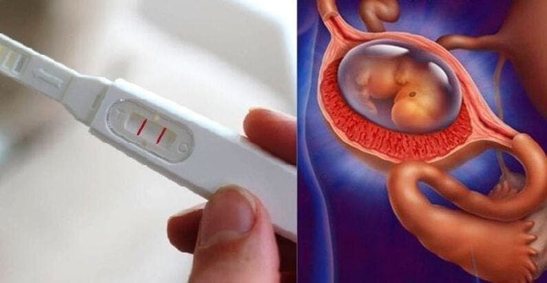 Mang thai ngoài tử cung thử que có biết không? Dấu hiệu nhận biết thai ngoài tử cung
