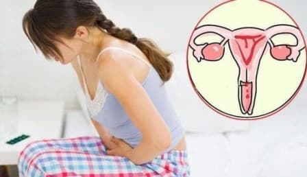 Tránh thai nội tiết có thực sự tốt cho phụ nữ?