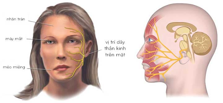Phụ nữ mang thai bị liệt dây thần kinh số 7 thì nên làm gì?