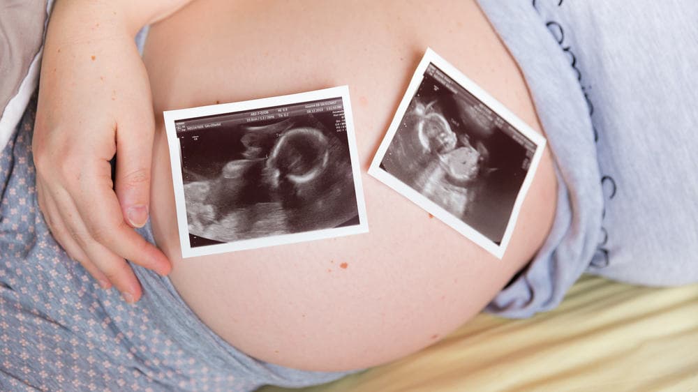 “Đẻ không đau” và những tác dụng phụ có thể mẹ chưa biết