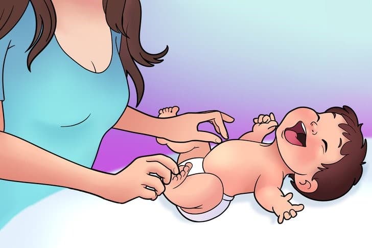 Thoát vị rốn sơ sinh: Dấu hiệu và những điều cha mẹ cần biết