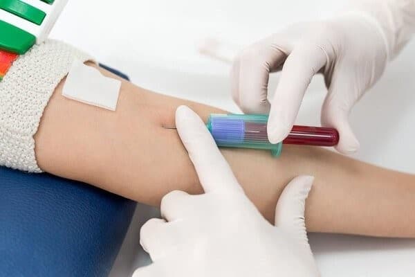 3 xét nghiệm sàng lọc trước sinh đặc biệt quan trọng trong thai kỳ, mẹ bầu bận đến mấy cũng nhớ phải đi thực hiện đúng lịch