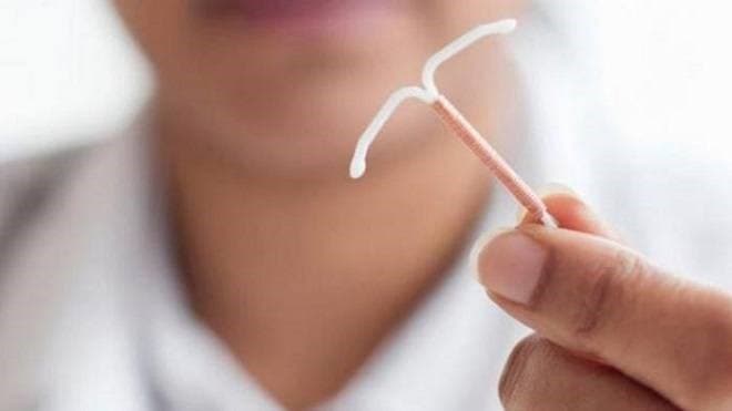 Sinh mổ bao lâu thì đặt vòng được? Ưu và nhược điểm của vòng tránh thai